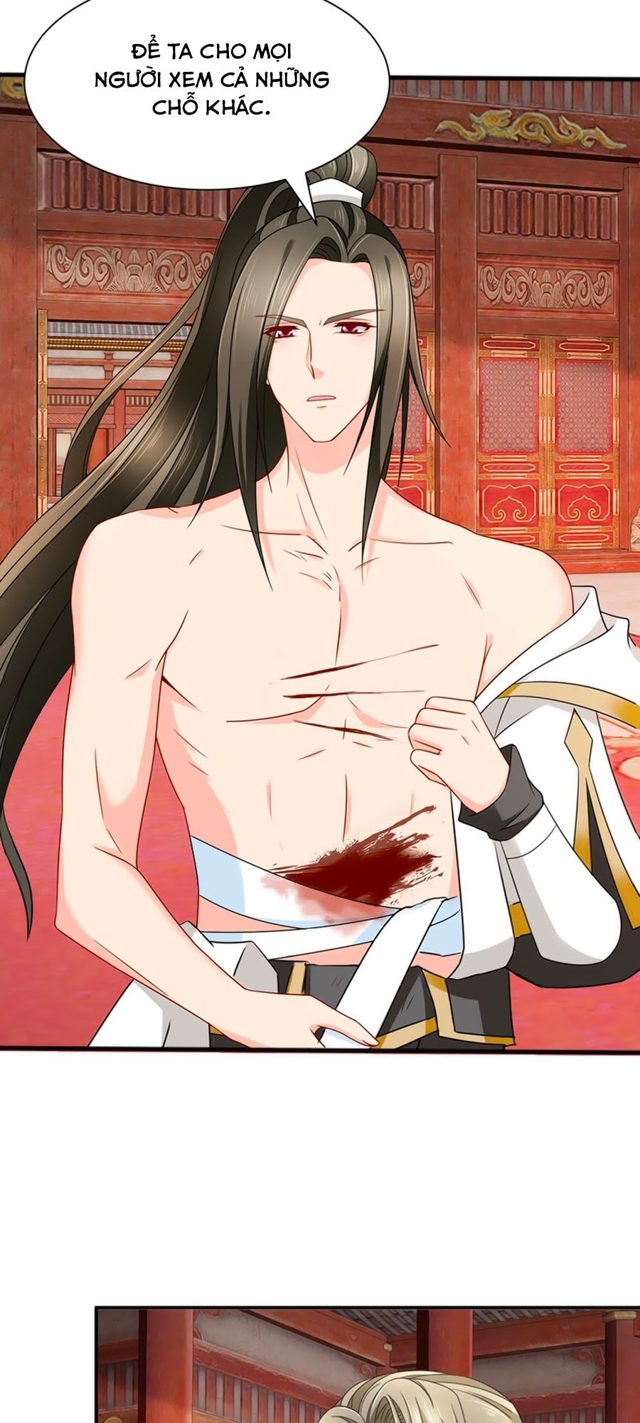 Kiêu Sủng Y Phi: Chapter 175