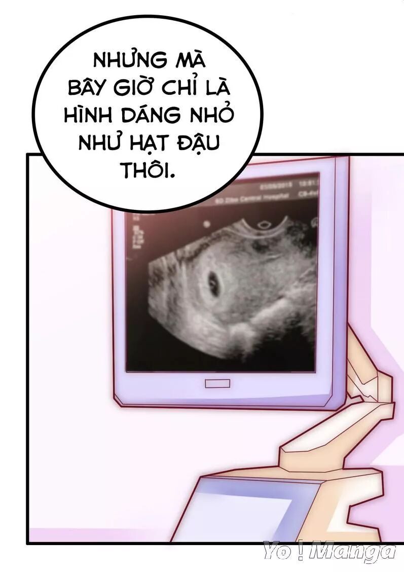 Băng Sơn Tổng Tài Cường Sủng Thê: Chapter 88: Gọi Nó Là Hạt Đậu Nhỏ Đi!