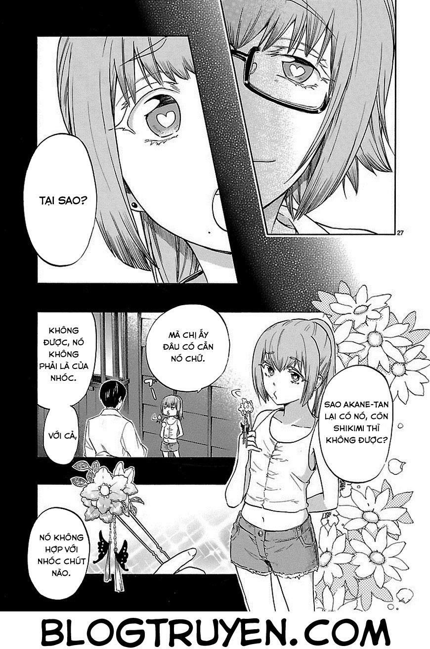 Nụ Hôn Tử Thần: Chapter 31